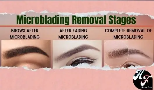 Microblading Removal