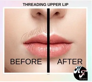 Upper Lip Threading Before And After