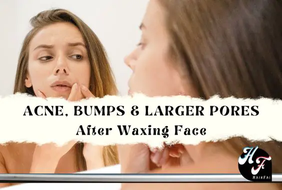 Does Face Waxing Cause Acne, Bumps, & Larger Pores