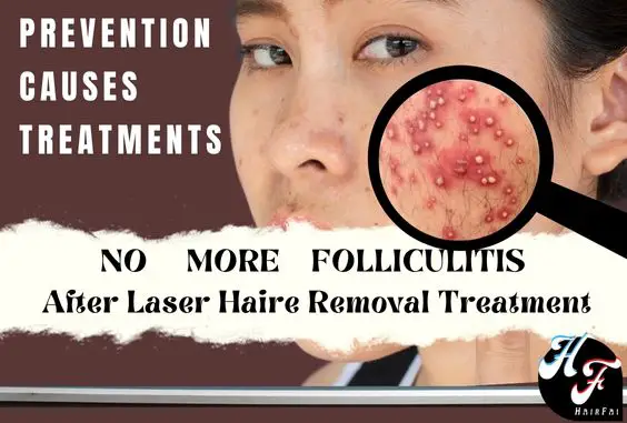Folliculitis After Laser Hair Removal -Treated & Explained