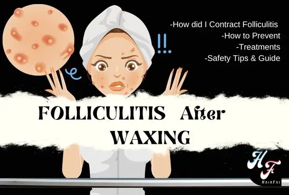 Folliculitis After Waxing- How To Treat & Prevent