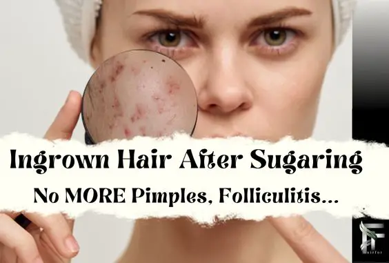 Ingrown Hair & Folliculitis After Sugaring- Prevent & Fix